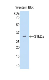 POMC / Proopiomelanocortin Antibody - Western blot of recombinant POMC / MSH / ACTH.  This image was taken for the unconjugated form of this product. Other forms have not been tested.