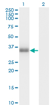 POMC / Proopiomelanocortin Antibody - Western Blot analysis of POMC expression in transfected 293T cell line by POMC monoclonal antibody (M01), clone 3E11.Lane 1: POMC transfected lysate(29.4 KDa).Lane 2: Non-transfected lysate.