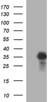 POMC / Proopiomelanocortin Antibody - HEK293T cells were transfected with the pCMV6-ENTRY control (Left lane) or pCMV6-ENTRY POMC (Right lane) cDNA for 48 hrs and lysed. Equivalent amounts of cell lysates (5 ug per lane) were separated by SDS-PAGE and immunoblotted with anti-POMC.