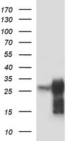 POMC / Proopiomelanocortin Antibody - HEK293T cells were transfected with the pCMV6-ENTRY control (Left lane) or pCMV6-ENTRY POMC (Right lane) cDNA for 48 hrs and lysed. Equivalent amounts of cell lysates (5 ug per lane) were separated by SDS-PAGE and immunoblotted with anti-POMC.