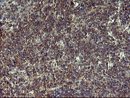POMC / Proopiomelanocortin Antibody - IHC of paraffin-embedded Human lymph node tissue using anti-POMC mouse monoclonal antibody. (Heat-induced epitope retrieval by 10mM citric buffer, pH6.0, 120°C for 3min).