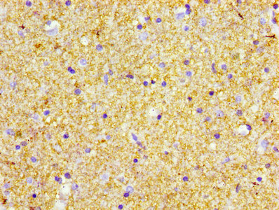 POMC / Proopiomelanocortin Antibody - IHC image of POMC Antibody diluted at 1:600 and staining in paraffin-embedded human brain tissue performed on a Leica BondTM system. After dewaxing and hydration, antigen retrieval was mediated by high pressure in a citrate buffer (pH 6.0). Section was blocked with 10% normal goat serum 30min at RT. Then primary antibody (1% BSA) was incubated at 4°C overnight. The primary is detected by a biotinylated secondary antibody and visualized using an HRP conjugated SP system.