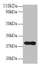 POMC / Proopiomelanocortin Antibody - Western blot All lanes: Pro-opiomelanocortin antibody at 2µg/ml + NIH/3T3 whole cell lysate Secondary Goat polyclonal to rabbit IgG at 1/10000 dilution Predicted band size: 29 kDa Observed band size: 29 kDa