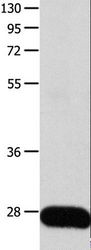 POMC / Proopiomelanocortin Antibody - Western blot analysis of Human liver cancer tissue, using POMC Polyclonal Antibody at dilution of 1:450.