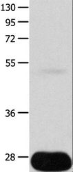 POMC / Proopiomelanocortin Antibody - Western blot analysis of Human liver cancer tissue, using POMC Polyclonal Antibody at dilution of 1:450.
