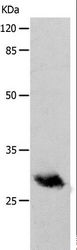 POMC / Proopiomelanocortin Antibody - Western blot analysis of Human fetal brain tissue, using POMC Polyclonal Antibody at dilution of 1:400.