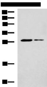 POMC / Proopiomelanocortin Antibody - Western blot analysis of Mouse liver tissue and Mouse skeletal muscle tissue lysates  using POMC Polyclonal Antibody at dilution of 1:800