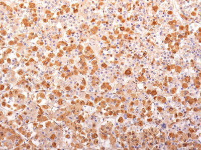 POMC / Proopiomelanocortin Antibody - Formalin-fixed, paraffin-embedded human Pituitary Gland stained with ACTH Mouse Recombinant Monoclonal Antibody (r57).