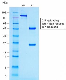 POMC / Proopiomelanocortin Antibody - SDS-PAGE Analysis Purified ACTH Mouse Recombinant Monoclonal Antibody (r57). Confirmation of Purity and Integrity of Antibody.