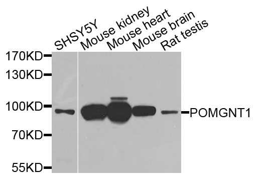 POMGNT1 Antibody - Western blot analysis of extracts of various cells.