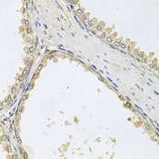 POMGNT1 Antibody - Immunohistochemistry of paraffin-embedded human prostate.