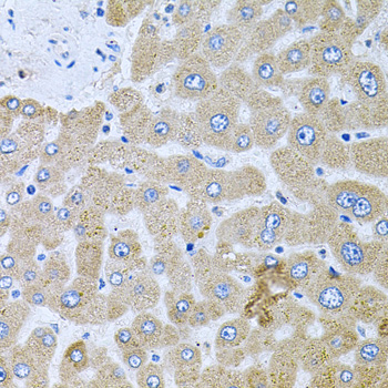 POMGNT1 Antibody - Immunohistochemistry of paraffin-embedded human liver injury tissue.