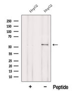 POMGNT1 Antibody - Western blot analysis of extracts of HepG2 cells using MGAT1 antibody. The lane on the left was treated with blocking peptide.