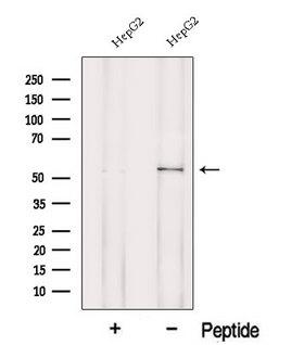 POMGNT1 Antibody - Western blot analysis of extracts of HepG2 cells using MGAT1 antibody. The lane on the left was treated with blocking peptide.