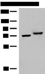 POMGNT1 Antibody - Western blot analysis of A172 and HepG2 cell lysates  using POMGNT1 Polyclonal Antibody at dilution of 1:400