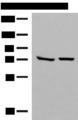 POMGNT1 Antibody - Western blot analysis of HepG2 and A172 cell lysates  using POMGNT1 Polyclonal Antibody at dilution of 1:250
