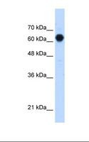 POMGNT2 / GTDC2 Antibody - HepG2 cell lysate. Antibody concentration: 1.25 ug/ml. Gel concentration: 12%.  This image was taken for the unconjugated form of this product. Other forms have not been tested.