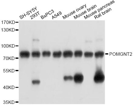 POMGNT2 / GTDC2 Antibody - Western blot analysis of extracts of various cell lines, using POMGNT2 antibody at 1:3000 dilution. The secondary antibody used was an HRP Goat Anti-Rabbit IgG (H+L) at 1:10000 dilution. Lysates were loaded 25ug per lane and 3% nonfat dry milk in TBST was used for blocking. An ECL Kit was used for detection and the exposure time was 1s.
