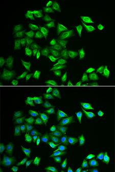 POMGNT2 / GTDC2 Antibody - Immunofluorescence analysis of A549 cells using POMGNT2 Polyclonal Antibody.