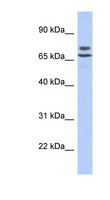 POMGNT2 / GTDC2 Antibody - C3orf39 antibody Western blot of SH-SYSY lysate. This image was taken for the unconjugated form of this product. Other forms have not been tested.