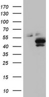 POMK / SGK196 Antibody - HEK293T cells were transfected with the pCMV6-ENTRY control. (Left lane) or pCMV6-ENTRY SGK196. (Right lane) cDNA for 48 hrs and lysed. Equivalent amounts of cell lysates. (5 ug per lane) were separated by SDS-PAGE and immunoblotted with anti-SGK196.