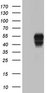 POMK / SGK196 Antibody - HEK293T cells were transfected with the pCMV6-ENTRY control (Left lane) or pCMV6-ENTRY SGK196 (Right lane) cDNA for 48 hrs and lysed. Equivalent amounts of cell lysates (5 ug per lane) were separated by SDS-PAGE and immunoblotted with anti-SGK196.
