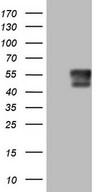 POMK / SGK196 Antibody - HEK293T cells were transfected with the pCMV6-ENTRY control. (Left lane) or pCMV6-ENTRY SGK196. (Right lane) cDNA for 48 hrs and lysed. Equivalent amounts of cell lysates. (5 ug per lane) were separated by SDS-PAGE and immunoblotted with anti-SGK196.