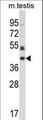 POMK / SGK196 Antibody - Mouse Sgk196 Antibody western blot of mouse testis tissue lysates (35 ug/lane). The Sgk196 antibody detected the Sgk196 protein (arrow).