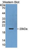 POMP / HSPC014 Antibody - Western blot of POMP / HSPC014 antibody.
