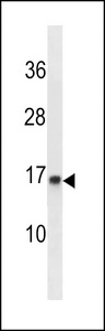POMP / HSPC014 Antibody - POMP Antibody western blot of WiDr cell line lysates (35 ug/lane). The POMP antibody detected the POMP protein (arrow).