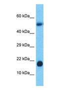 POMP / HSPC014 Antibody - Western blot of POMP Antibody with human Stomach Tumor lysate.  This image was taken for the unconjugated form of this product. Other forms have not been tested.