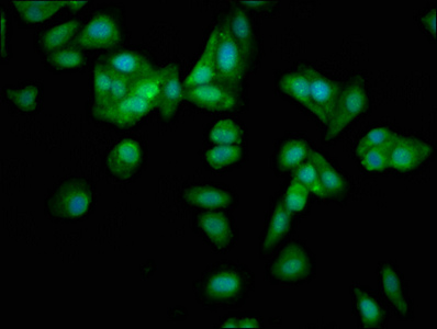 POMP / HSPC014 Antibody - Immunofluorescence staining of HepG2 cells with POMP Antibody at 1:133, counter-stained with DAPI. The cells were fixed in 4% formaldehyde, permeabilized using 0.2% Triton X-100 and blocked in 10% normal Goat Serum. The cells were then incubated with the antibody overnight at 4°C. The secondary antibody was Alexa Fluor 488-congugated AffiniPure Goat Anti-Rabbit IgG(H+L).