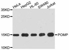 POMP / HSPC014 Antibody - Western blot analysis of extracts of various cell lines.