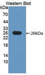 POMT1 Antibody - Western blot of POMT1 antibody.