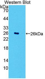 POMT1 Antibody - Western blot of POMT1 antibody.