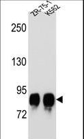 POMT1 Antibody - POMT1 Antibody western blot of ZR-75-1,K562 cell line lysates (35 ug/lane). The POMT1 antibody detected the POMT1 protein (arrow).