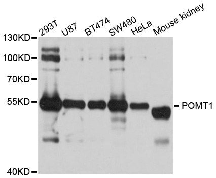 POMT1 Antibody - Western blot analysis of extracts of various cell lines, using POMT1 antibody at 1:1000 dilution. The secondary antibody used was an HRP Goat Anti-Rabbit IgG (H+L) at 1:10000 dilution. Lysates were loaded 25ug per lane and 3% nonfat dry milk in TBST was used for blocking. An ECL Kit was used for detection and the exposure time was 5s.