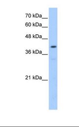 POMT2 Antibody - HepG2 cell lysate. Antibody concentration: 0.25 ug/ml. Gel concentration: 12%.  This image was taken for the unconjugated form of this product. Other forms have not been tested.