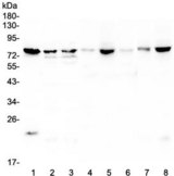 POMT2 Antibody - Western blot testing of 1) human PC-3, 2) human Caco-2, 3) human HepG2, 4) rat lung, 5) rat testis, 6) rat spleen, 7) mouse lung and 8) mouse testis lysate with POMT2 antibody at 0.5ug/ml. Predicted molecular weight ~84 kDa.