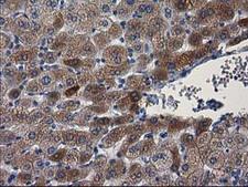 PON1 / ESA Antibody - IHC of paraffin-embedded Human liver tissue using anti-PON1 mouse monoclonal antibody.