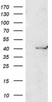 PON1 / ESA Antibody - HEK293T cells were transfected with the pCMV6-ENTRY control (Left lane) or pCMV6-ENTRY PON1 (Right lane) cDNA for 48 hrs and lysed. Equivalent amounts of cell lysates (5 ug per lane) were separated by SDS-PAGE and immunoblotted with anti-PON1.