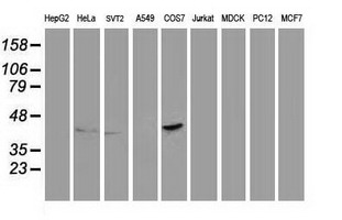 PON1 / ESA Antibody - Western blot of extracts (35 ug) from 9 different cell lines by using anti-PON1 monoclonal antibody.
