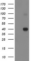 PON1 / ESA Antibody - HEK293T cells were transfected with the pCMV6-ENTRY control (Left lane) or pCMV6-ENTRY PON1 (Right lane) cDNA for 48 hrs and lysed. Equivalent amounts of cell lysates (5 ug per lane) were separated by SDS-PAGE and immunoblotted with anti-PON1.
