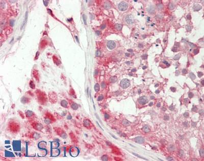 PON1 / ESA Antibody - Human Testis: Formalin-Fixed, Paraffin-Embedded (FFPE).  This image was taken for the unconjugated form of this product. Other forms have not been tested.