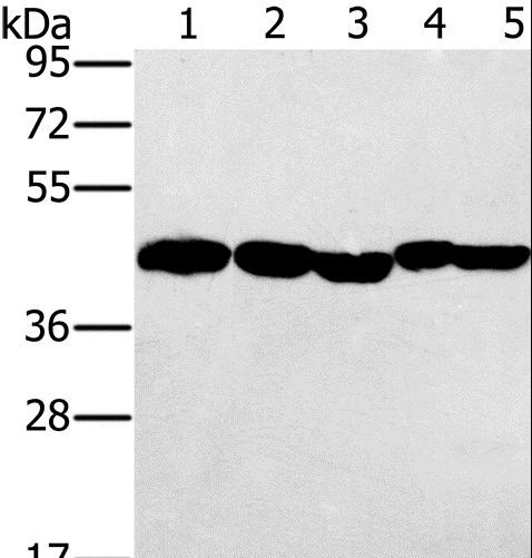 PON1 / ESA Antibody - Western blot analysis of HeLa, skov3 and A549 cell, mouse liver and human ovarian cancer tissue, using PON1 Polyclonal Antibody at dilution of 1:500.
