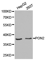 PON2 Antibody - Western blot of extracts of various cell lines, using PON2 antibody.