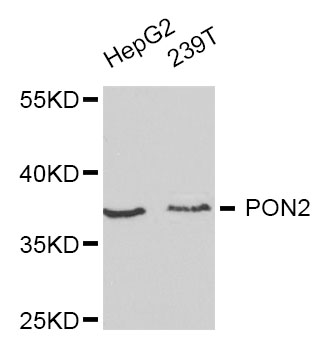 PON2 Antibody - Western blot analysis of extracts of various cell lines, using PON2 antibody at 1:1000 dilution. The secondary antibody used was an HRP Goat Anti-Rabbit IgG (H+L) at 1:10000 dilution. Lysates were loaded 25ug per lane and 3% nonfat dry milk in TBST was used for blocking.