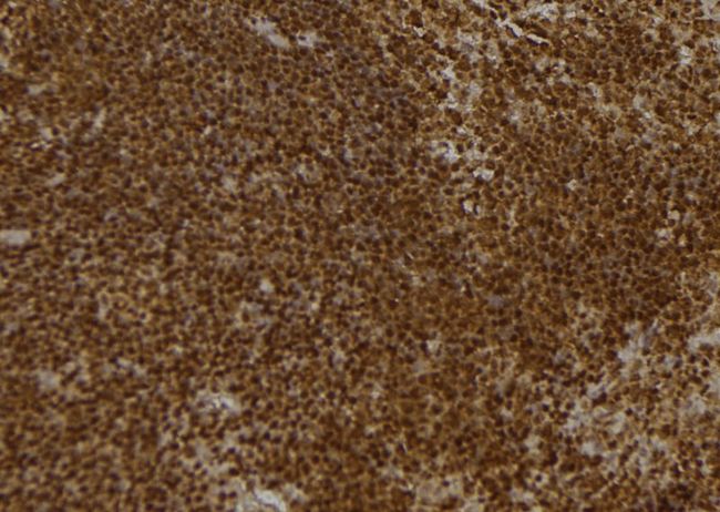 PON2 Antibody - 1:100 staining mouse spleen tissue by IHC-P. The sample was formaldehyde fixed and a heat mediated antigen retrieval step in citrate buffer was performed. The sample was then blocked and incubated with the antibody for 1.5 hours at 22°C. An HRP conjugated goat anti-rabbit antibody was used as the secondary.