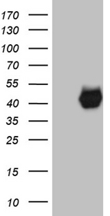 PON3 Antibody - HEK293T cells were transfected with the pCMV6-ENTRY control. (Left lane) or pCMV6-ENTRY PON3. (Right lane) cDNA for 48 hrs and lysed. Equivalent amounts of cell lysates. (5 ug per lane) were separated by SDS-PAGE and immunoblotted with anti-PON3. (1:2000)
