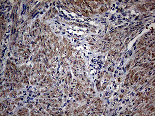 PON3 Antibody - Immunohistochemical staining of paraffin-embedded Human endometrium tissue within the normal limits using anti-PON3 mouse monoclonal antibody. (Heat-induced epitope retrieval by 1mM EDTA in 10mM Tris buffer. (pH8.5) at 120°C for 3 min. (1:2000)